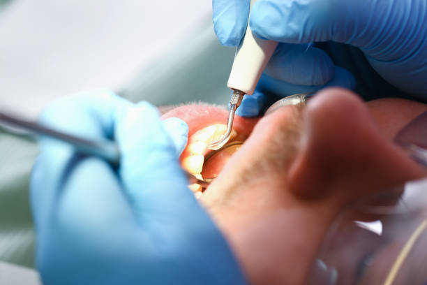 Best Weekend Emergency Dental Services in Pinckney, MI