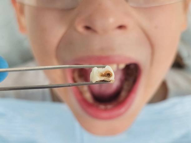 Best Walk-In Emergency Dental Services in Pinckney, MI