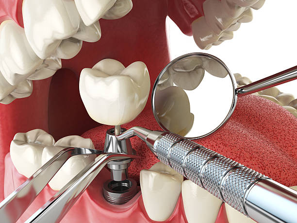 Best Emergency Denture Repair in Pinckney, MI